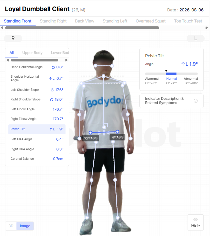 Body Analysis Results - Pelvic Tilt